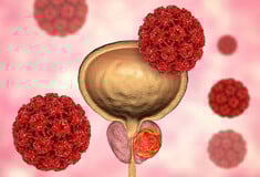 Φάρμακο για τον καρκίνο του προστάτη που παρατείνει τη ζωή θα διατεθεί στην Αγγλία