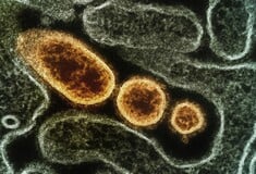 Γρίπη: Δεκάδες κρούσματα στα νοσοκομεία - Κυριαρχεί η υποπαραλλαγή Κ