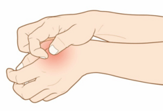 ΑΤΟΠΙΚΗ ΔΕΡΜΑΤΙΤΙΔΑ ΕΡΕΥΝΑ