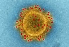 Nipah: Τι είναι, πού εντοπίζεται και πώς μεταδίδεται ο επικίνδυνος ιός