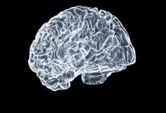 ΕΓΚΕΦΑΛΟ ΑΝΟΙΑ ΠΡΑΚΤΙΚΕΣ