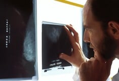 ΤΕΧΝΗΤΗ ΝΟΗΜΟΣΥΝΗ ΜΑΣΤΟΓΡΑΦΙΑ