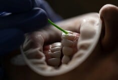 ΛΟΙΜΩΞΗ ΔΟΝΤΙ ΚΑΡΔΙΑ