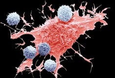 ΚΑΡΚΙΝΟΣ ΠΑΧΕΟΣ ΕΝΤΕΡΟΥ ΤΡΟΦΕΣ