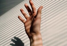 ΔΕΡΜΑ ΜΙΚΡΟΟΡΓΑΝΙΣΜΟΙ