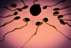 ΣΠΕΡΜΑΤΟΖΩΑΡΙΑ ΔΙΑΣΤΗΜΑ ΜΙΚΡΟΒΑΡΥΤΗΤΑ