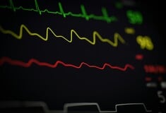 ΚΑΡΔΙΑ ΑΡΡΥΘΜΙΑ ΤΑΧΥΚΑΡΔΙΑ ΕΡΕΥΝΑ