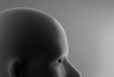 ΓΟΝΙΔΙΑΚΗ ΘΕΡΑΠΕΙΑ ΕΝΕΣΗ ΑΚΟΗ