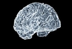 ΑΝΕΥΡΥΣΜΑ ΕΓΚΕΦΑΛΟΥ ΤΙ ΕΙΝΑΙ ΠΩΣ ΑΝΑΓΝΩΡΙΖΕΤΑΙ