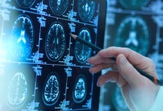 «Πρωτοποριακά φάρμακα» για το Αλτσχάιμερ είναι απίθανο να ωφελήσουν ασθενείς, σύμφωνα με μελέτη