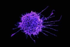 ΕΡΕΥΝΑ ΚΑΡΚΙΝΟΣ ΚΥΤΤΑΡΑ ΓΕΝΕΤΙΚΗ