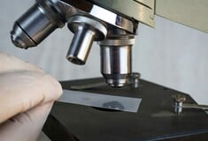 ΟΡΑΣΗ ΘΕΡΑΠΕΙΑ ΒΡΑΒΕΙΑ ΤΥΦΛΩΣΗ ΑΝΑΙΜΙΑ