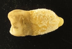 ΜΟΥΜΙΑ ΔΟΝΤΙ ΟΣΤΡΑΚΙΑ