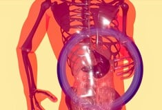 ΜΕΛΕΤΗ ΣΩΜΑ ΒΑΡΟΣ