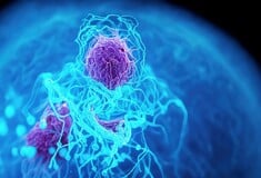 ΚΑΡΚΙΝΟΣ ΠΑΓΚΡΕΑΣ ΤΕΧΝΗΤΗ ΝΟΗΜΟΣΥΝΗ ΕΝΤΟΠΙΣΜΟΣ 