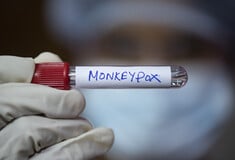 MPOX ΗΠΑ ΕΡΕΥΝΗΤΕΣ ΙΟΣ