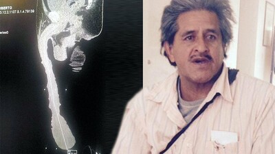 [ΝSFW] Πώς είναι να ζεις με μισό μέτρο πέος - Ο απίστευτος Μεξικανός με την πρωτοφανή ανατομία αποκαλύπτει