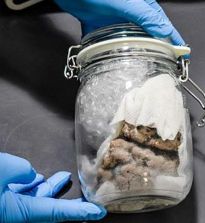 ΗΠΑ: Τελωνειακοί βρήκαν έναν ανθρώπινο εγκέφαλο μέσα σε βάζο