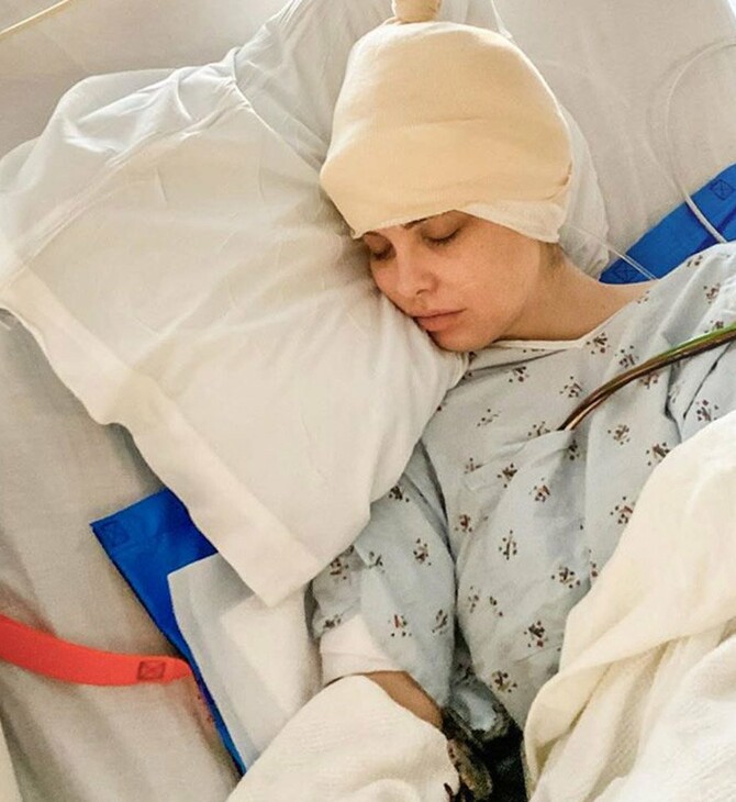 Έμιλι Σίαρς: Διάσημη ινφλουένσερ χειρουργήθηκε στον εγκέφαλο μένοντας ξύπνια - «Παράξενο και σουρεαλιστικό»