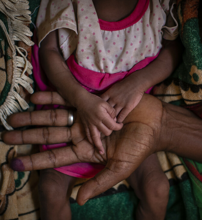 ΟΗΕ: Υποσιτισμός άνευ προηγουμένου πλήττει τις έγκυες και τις γυναίκες που θηλάζουν, στο Τιγκράι