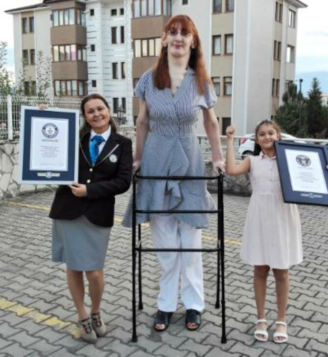 Ρεκόρ Γκίνες: H ψηλότερη γυναίκα στον κόσμο έχει ύψος 2.15 μ. και μιλά για το σπάνιο σύνδρομό της 