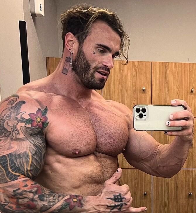 Ο πρώην Mr. Universe, Calum von Moger, δίνει μάχη για τη ζωή του- Έπεσε από παράθυρο δεύτερου ορόφου