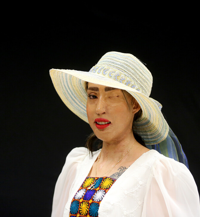 Σχεδιάστρια μόδας επιλέγει ως μοντέλα γυναίκες που έπεσαν θύματα επιθέσεων με οξύ