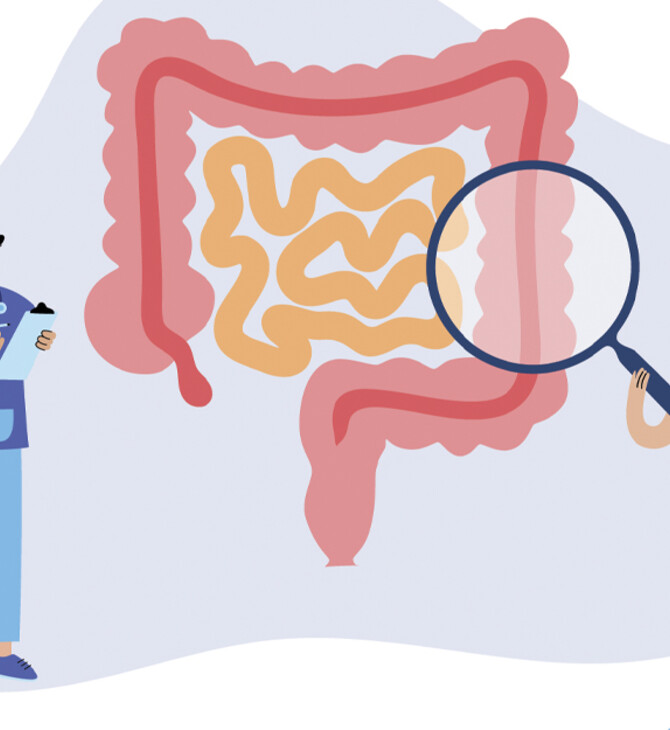 Μελέτη: Η κολονοσκόπηση δεν προλαμβάνει «τόσο καλά» τον θανατηφόρο καρκίνο παχέος εντέρου