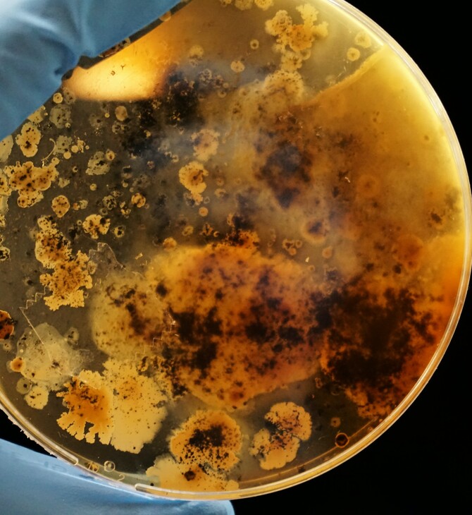 Ανησυχία από έκθεση του ΠΟΥ: Ανθεκτικά βακτήρια προκαλούν σοβαρές λοιμώξεις