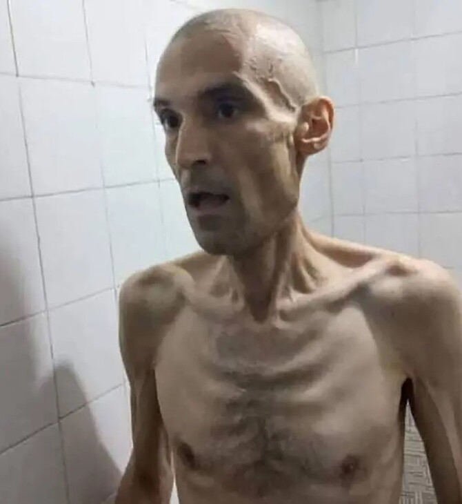 Startling photos show emaciated Iranian Dr. Farhad Meysami on hunger strike over hijab law