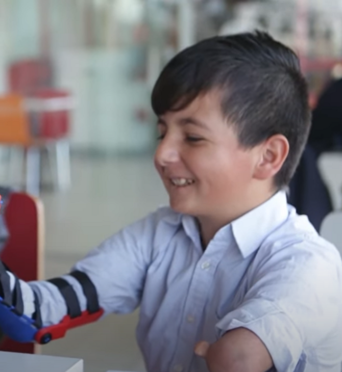 Ίδρυμα εκτυπώνει 3D προσθετικά μέλη και τα δωρίζει σε παιδιά στην Ουρουγουάη