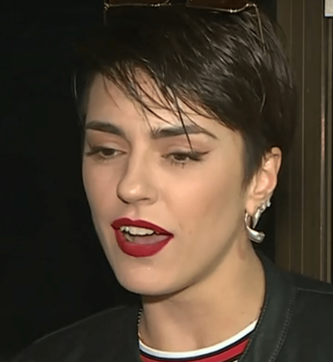 Κάτια Ταραμπάνκο: Ταμπού η ψωρίαση, έμεινα για καιρό εκτός μόντελινγκ