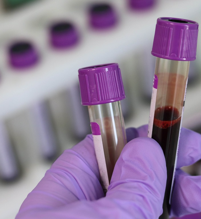 Τεστ αίματος ανιχνεύει 50 τύπους καρκίνου- Πώς μπορεί να επιταχύνει τη διάγνωση 