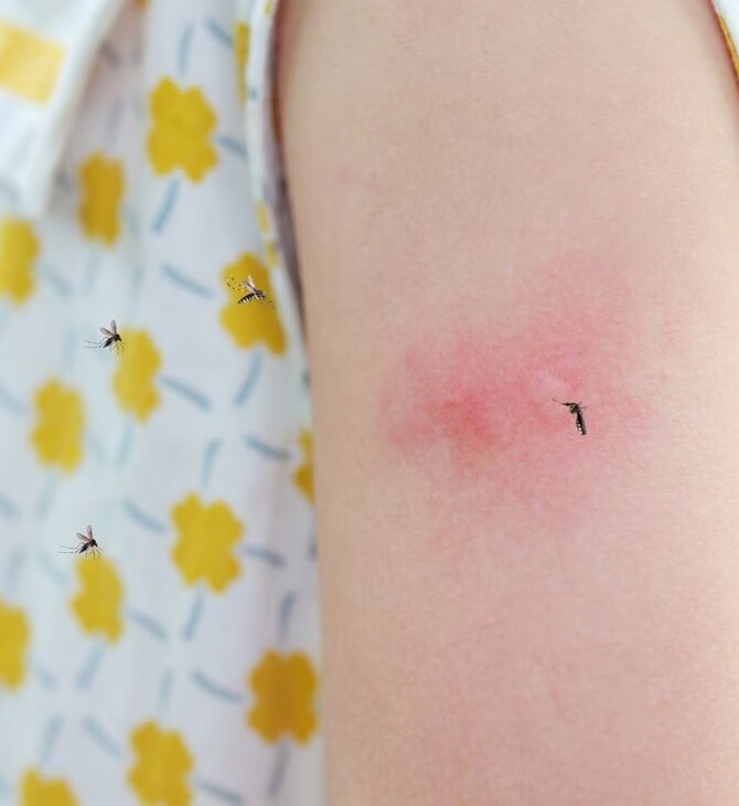 Πώς να γλιτώσετε από τα κουνούπια φέτος το καλοκαίρι. 