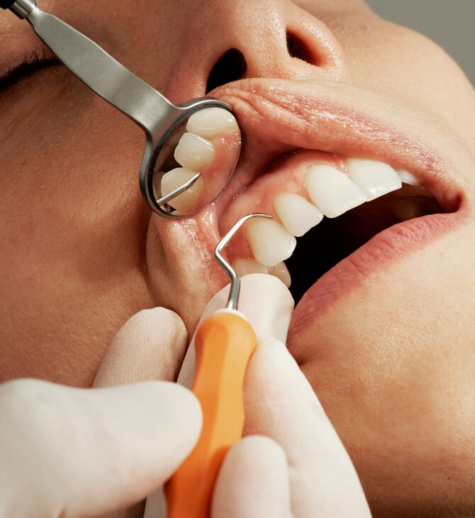άνω από 1.100 ασθενείς οδοντιατρείου καλούνται να κάνουν εξετάσεις για ηπατίτιδα και HIV