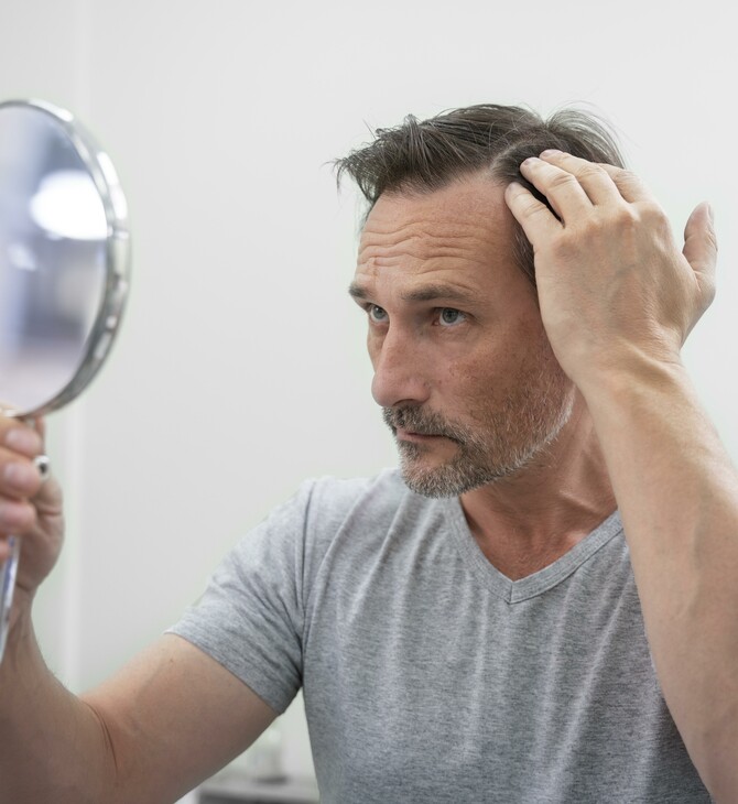 Δερματολογική Εταιρεία: Ένας στους τέσσερις άντρες χάνει μαλλιά πριν τα 20