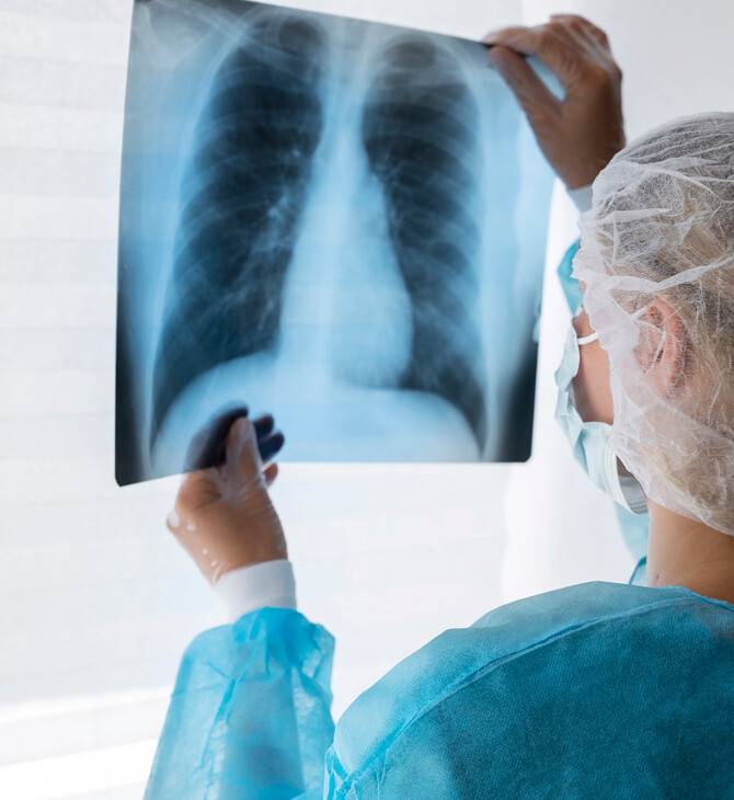 Καρκίνος του πνεύμονα: Νέο φάρμακο καταγράφει ανέλπιστα αποτελέσματα από οποιαδήποτε άλλη θεραπεία στην ιστορία