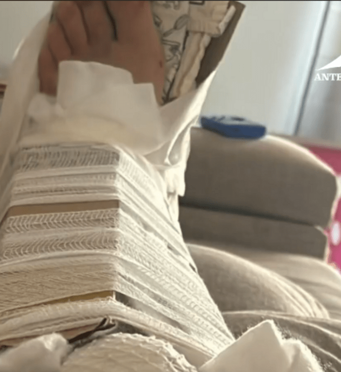 Ιταλία: Ακινητοποίησαν το σπασμένο πόδι 30χρονου με χάρτινο κουτί γιατί δεν είχαν γύψο