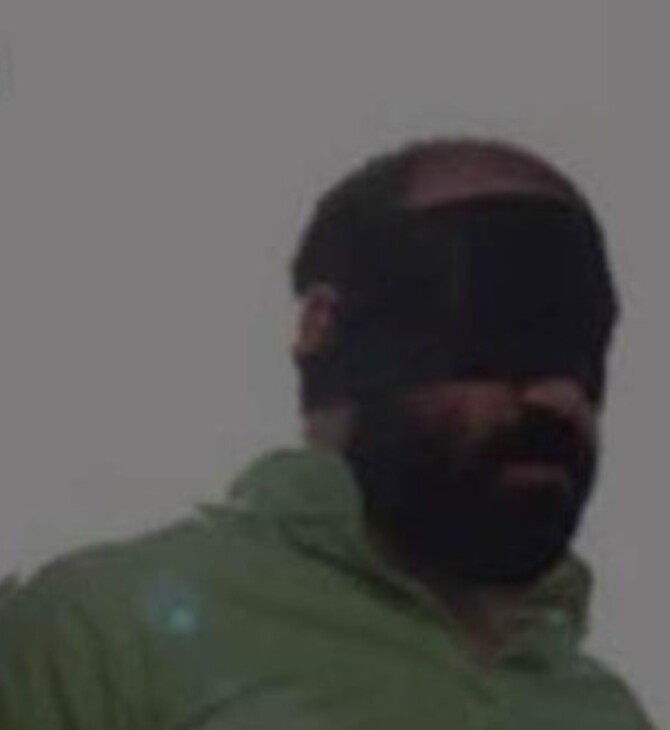 Ιράν: Ακρωτηρίασαν τα δάχτυλα σε δύο άνδρες που είχαν καταδικαστεί για κλοπή