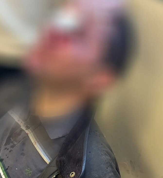 Ευθύνες στην ΕΛ.ΑΣ. αποδίδει το ΕΚΠΑ για την αιματηρή επίθεση κουκουλοφόρων στη Νομική 