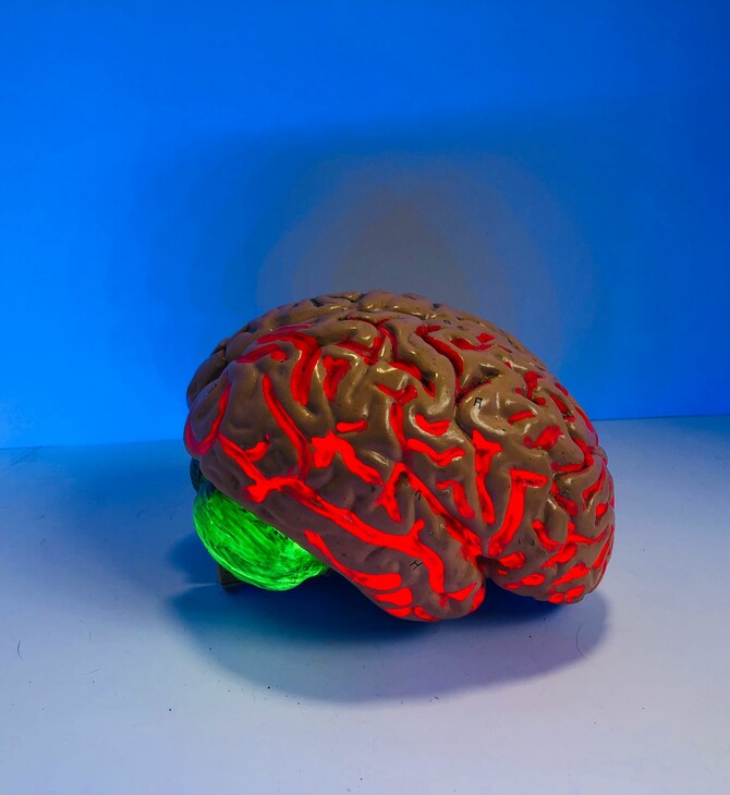 Γιατροί θεραπεύουν για πρώτη φορά τη νόσο του Χάντινγκτον και ξεσπούν σε δάκρυα συγκίνησης