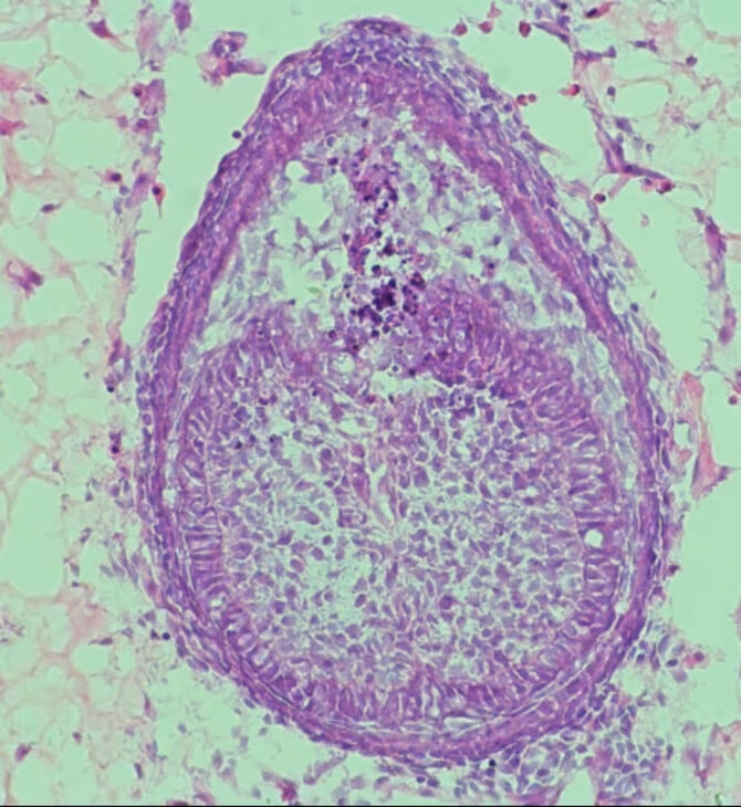 Πιο κοντά από ποτέ τα «ζωντανά» δόντια που καλλιεργούνται στο εργαστήριο