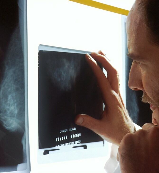 Καρκίνος του προστάτη: Η Αγγλία θέλει να επιταχύνει τη διάγνωση μέσω της τεχνητής νοημοσύνης