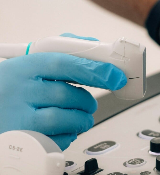 ΓΙΑ Σ/Κ: Πώς ένας απλός υπέρηχος λαιμού μπορεί να εντοπίσει τον κίνδυνο καρδιακής προσβολής και εγκεφαλικού