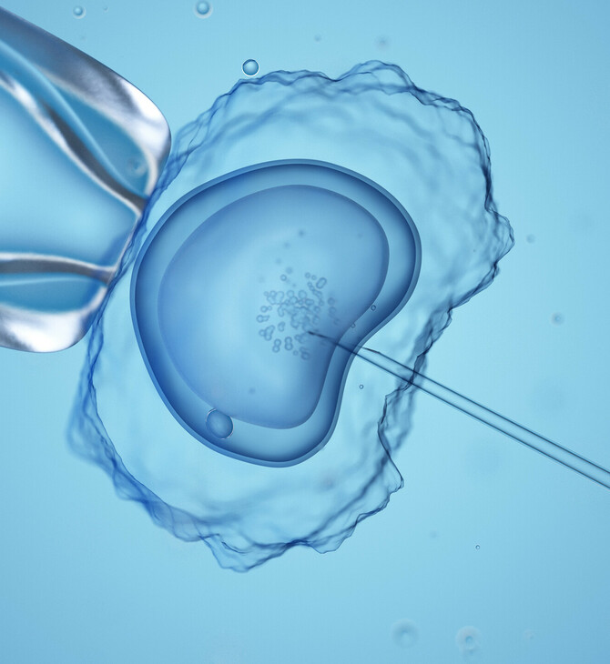 Άνδρες και υπογονιμότητα: Γιατροί προειδοποιούν ότι χιλιάδες ζευγάρια μπαίνουν άδικα σε IVF