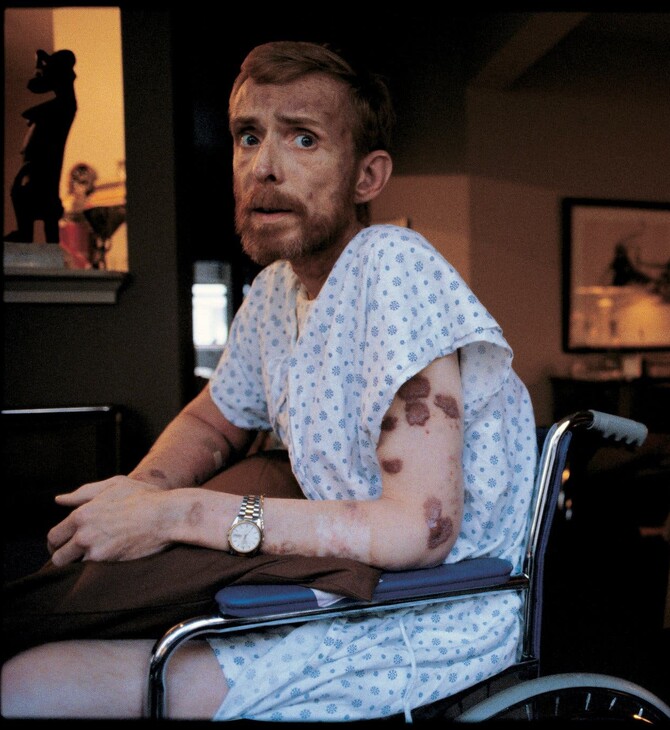 ΠΑΓΚΟΣΜΙΑ ΗΜΕΡΑ AIDS: ΑΥΤΟΙ ΠΟΥ ΔΕΝ ΠΡΟΛΑΒΑΝ