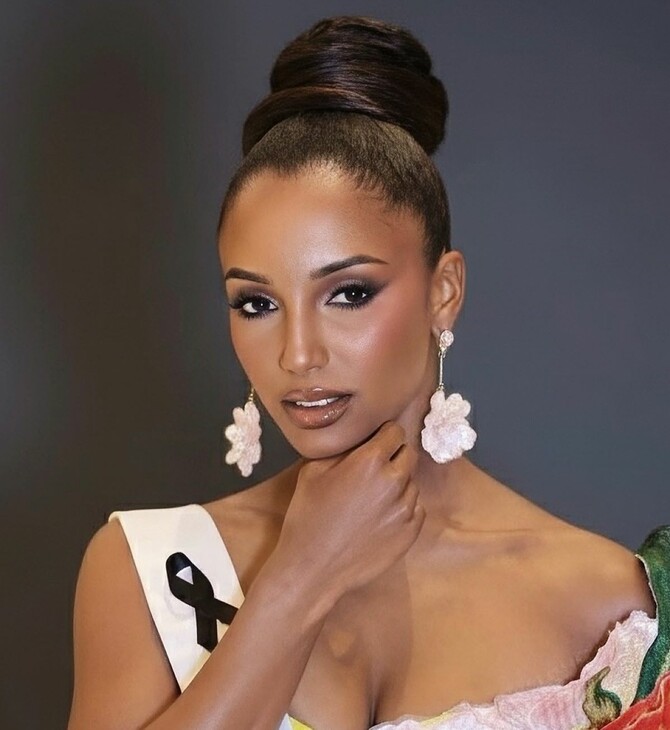 Με εγκεφαλική αιμορραγία η Μις Τζαμάικα μετά την πτώση της