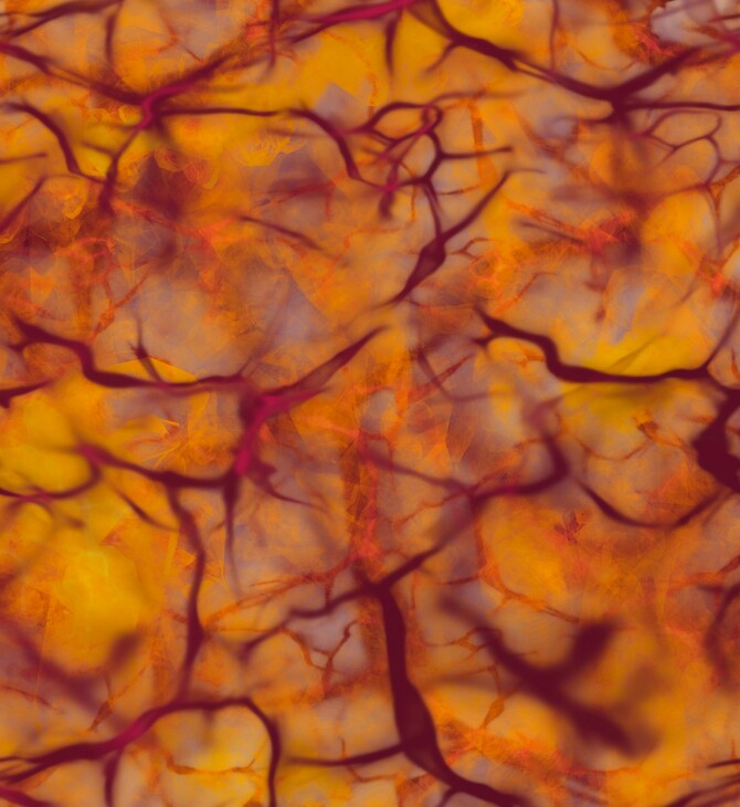 ΙΣΩΣ ΓΙΑ ΣΚ - Σκλήρυνση κατά πλάκας: Ανακαλύφθηκαν δύο υποτύποι με τη βοήθεια της τεχνητής νοημοσύνης 