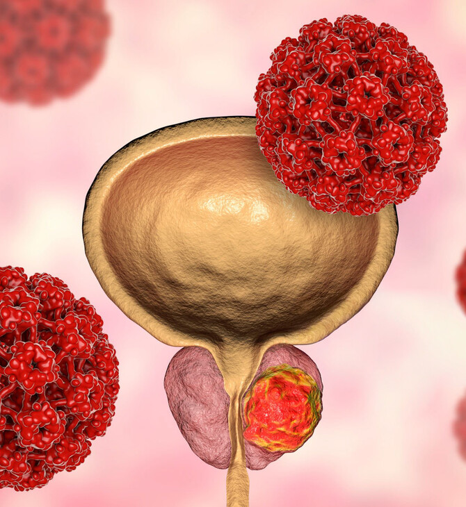 Φάρμακο για τον καρκίνο του προστάτη που παρατείνει τη ζωή θα διατεθεί στην Αγγλία