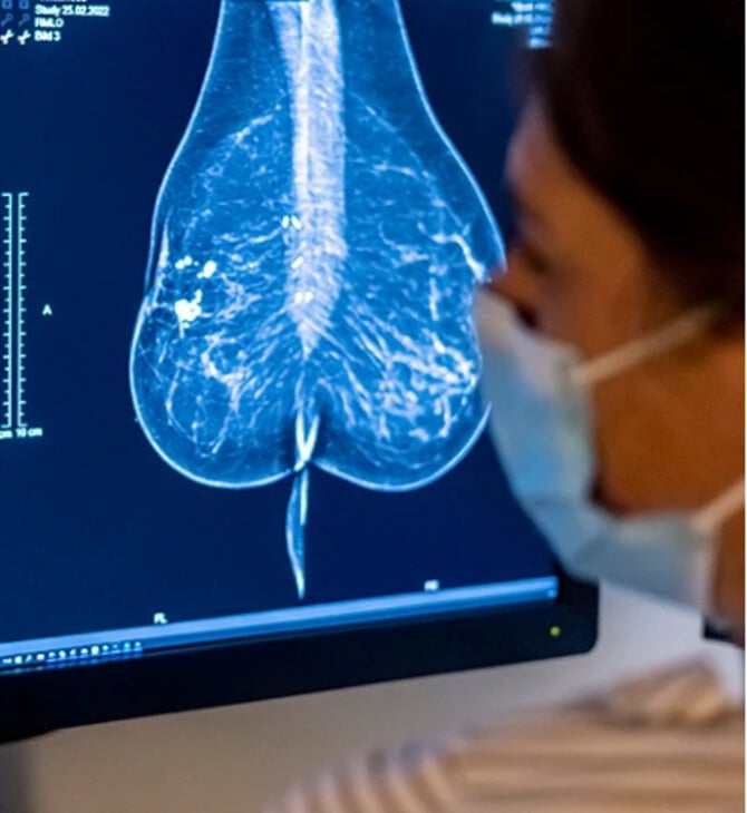 ΚΑΡΚΙΝΟΣ ΜΑΣΤΟΥ ΘΕΡΑΠΕΙΑ